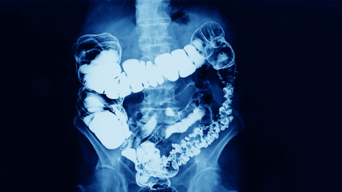 What Are Contrast Agents? Uses, Types, and Side Effects featured image