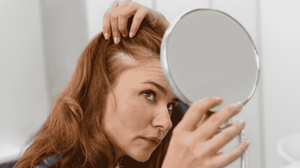 產後脫髮的女士